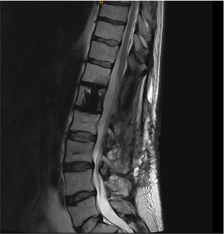 Advanced Radiation Therapy | icotec