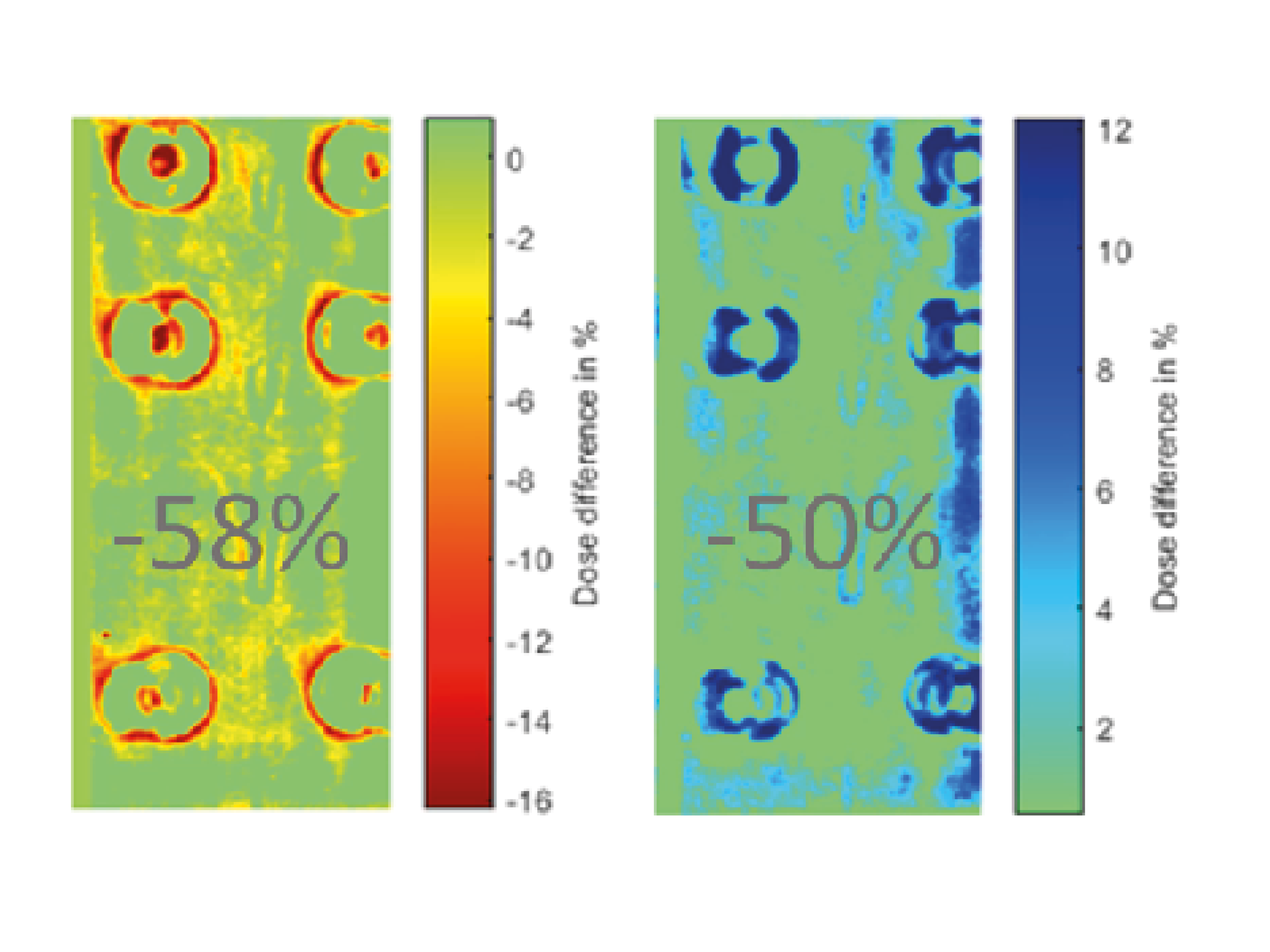 Scattering of radiation and radiation attenuation of a pedicle system made of BlackArmor® (Poel et al., 2020); there is a significant reduction of hot and cold spots by more than 50% compared to the titanium system